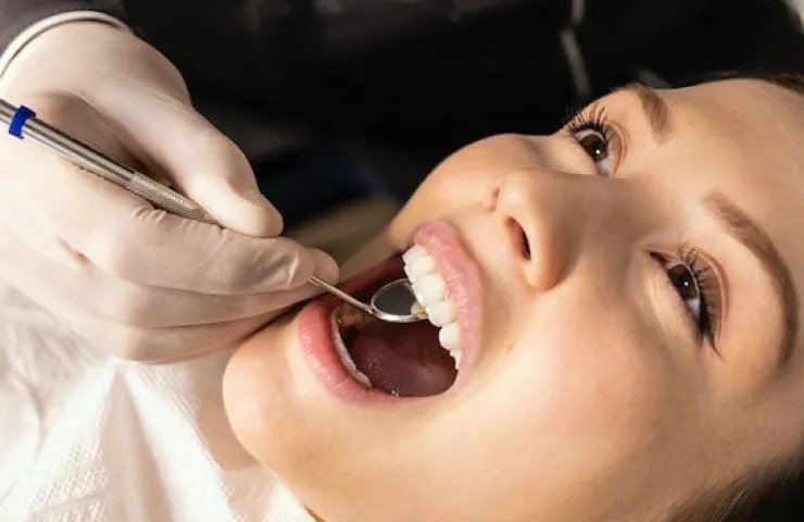 Professional teeth whitening at Smilo Family Dental